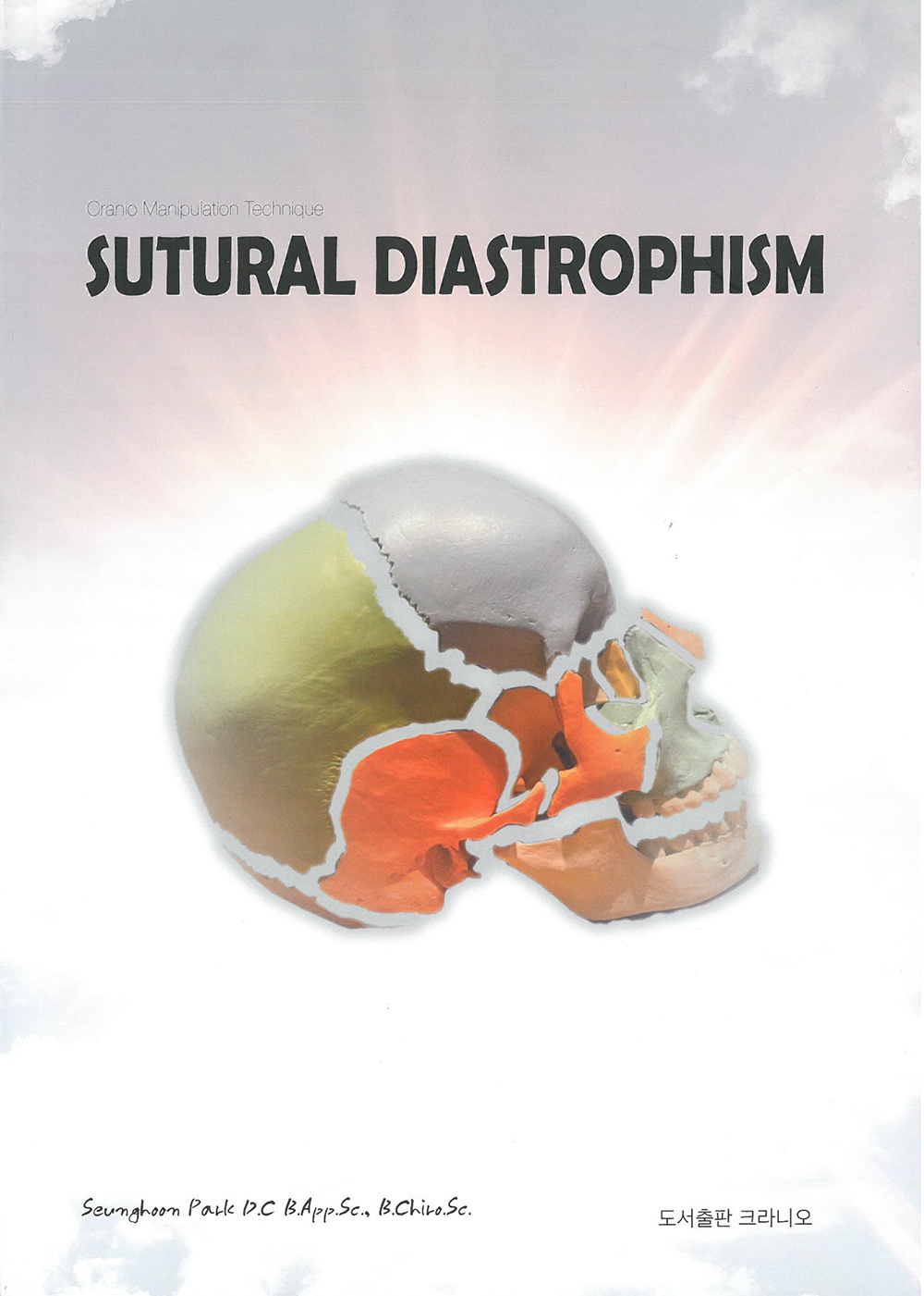 SUTURAL DIASTROPHISM